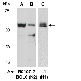 BCL6 Western Antibody (Abiocode)