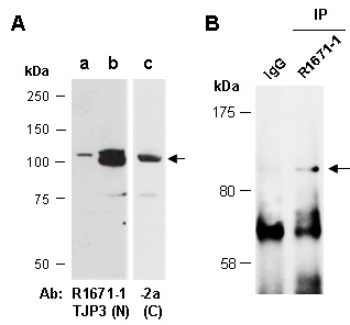 TJP3 Western IP Antibody (Abiocode)