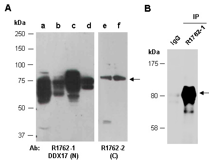 DDX17 Western Antibody (Abiocode)