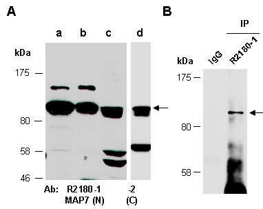 MAP7 Western IP Antibody (Abiocode)