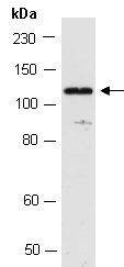 KDM4C Western Antibody (Abiocode)