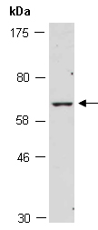 ZBTB7B Antibody Western (Abiocode)