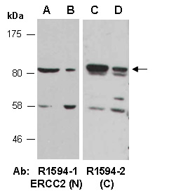 ERCC2 Antibody Western (Abiocode)