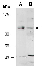 PTPN12 Antibody Western (Abiocode)