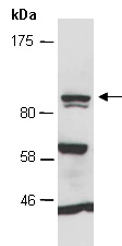 TBX3 Antibody Western (Abiocode)