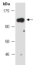 MMS19 Antibody Western (Abiocode)