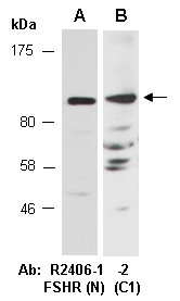 FSHR Antibody Western (Abiocode)