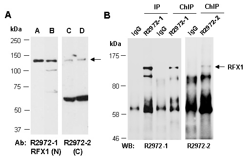 RFX1 Western IP ChIP Antibody (Abiocode)