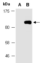 HA-Tag Antibody, Mouse Monoclonal Anitbody Western (Abiocode)