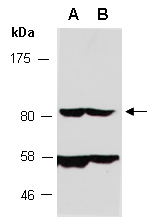 NF2 Antibody Western (Abiocode)