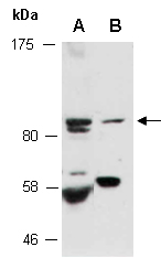 NF2 Antibody Western (Abiocode)