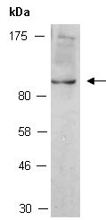 ERCC3 Antibody Western (Abiocode)