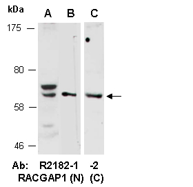 RACGAP1 Antibody Western (Abiocode)
