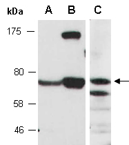 ACSL2 Antibody Western (Abiocode)