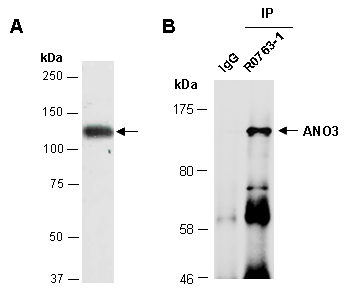 ANO3 Western IP Antibody (Abiocode)