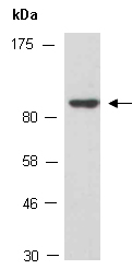 LHCGR Antibody Western (Abiocode)