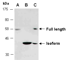 SLC29A3 ENT3 Antibody Abiocode