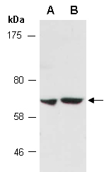SENP2 Antibody Western (Abiocode)