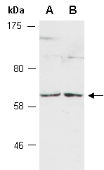 A1CF Antibody Western (Abiocode)