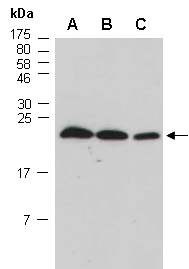 COMMD8 Antibody Western (Abiocode)