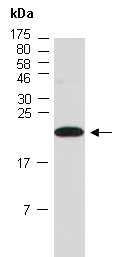 COMMD2 Antibody Western (Abiocode)
