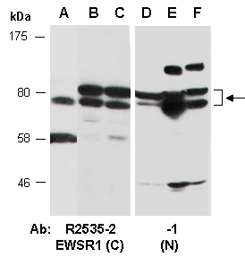 EWSR1 Antibody Western (Abiocode)