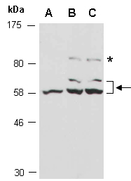GPC3 Antibody Western (Abiocode)