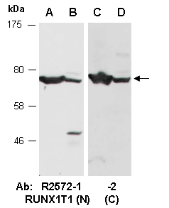RUNX1T1 Antibody Western (Abiocode)