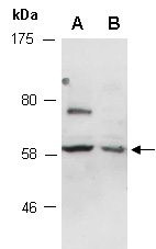 RALGPS1 Antibody Western (Abiocode)