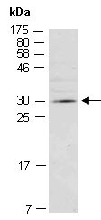 DLX4 Antibody Western (Abiocode)