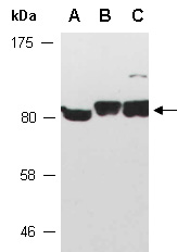 RECQL Antibody Western (Abiocode)