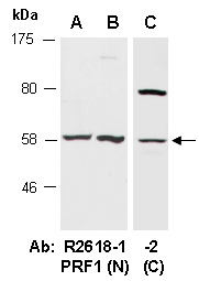 PRF1 Antibody Western (Abiocode)