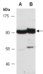 FUBP1 Antibody Western (Abiocode)