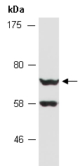 MEN1 Antibody Western (Abiocode)