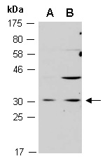 ELF5 Antibody Western (Abiocode)