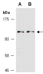OTUD7B Antibody Western (Abiocode)