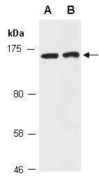 PPARGC1B Antibody Western (Abiocode)