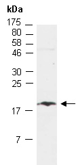 THRSP Antibody Western (Abiocode)