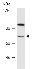 CPEB1 Antibody Western (Abiocode)