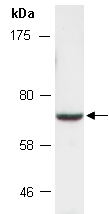 CPEB2 Antibody Western (Abiocode)