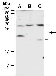 YKT6 Antibody Western (Abiocode)