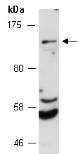 GLDC Antibody Western (Abiocode)