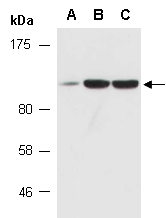 IFIH1 Antibody Western (Abiocode)