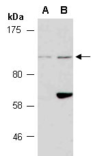 THAP9 Antibody Western (Abiocode)