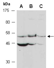 SESN2 Antibody Western (Abiocode)
