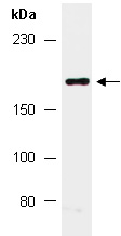 LRP6 Antibody Western (Abiocode)