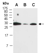 CCL18 Antibody Western (Abiocode)