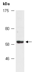 RIPK2 Antibody Western (Abiocode)
