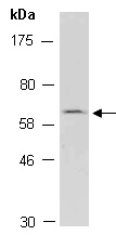 TBX15 Antibody Western (Abiocode)