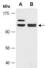 ASAP2 Antibody Western (Abiocode)